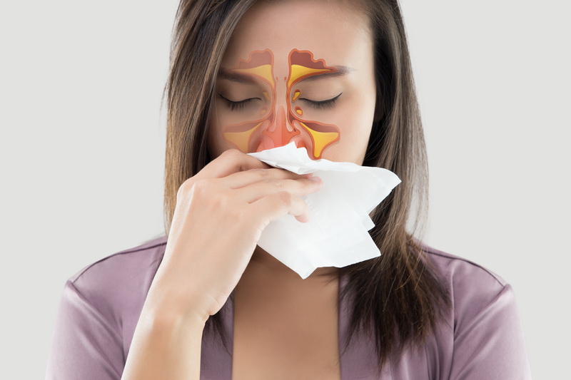 Синусит - распространенное воспалительное заболевание слизистой оболочки  пазух носа.