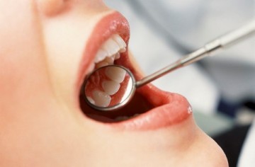 Современная стоматология. Лечение кариеса 